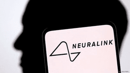 Neuralink faced issues with its wires for years