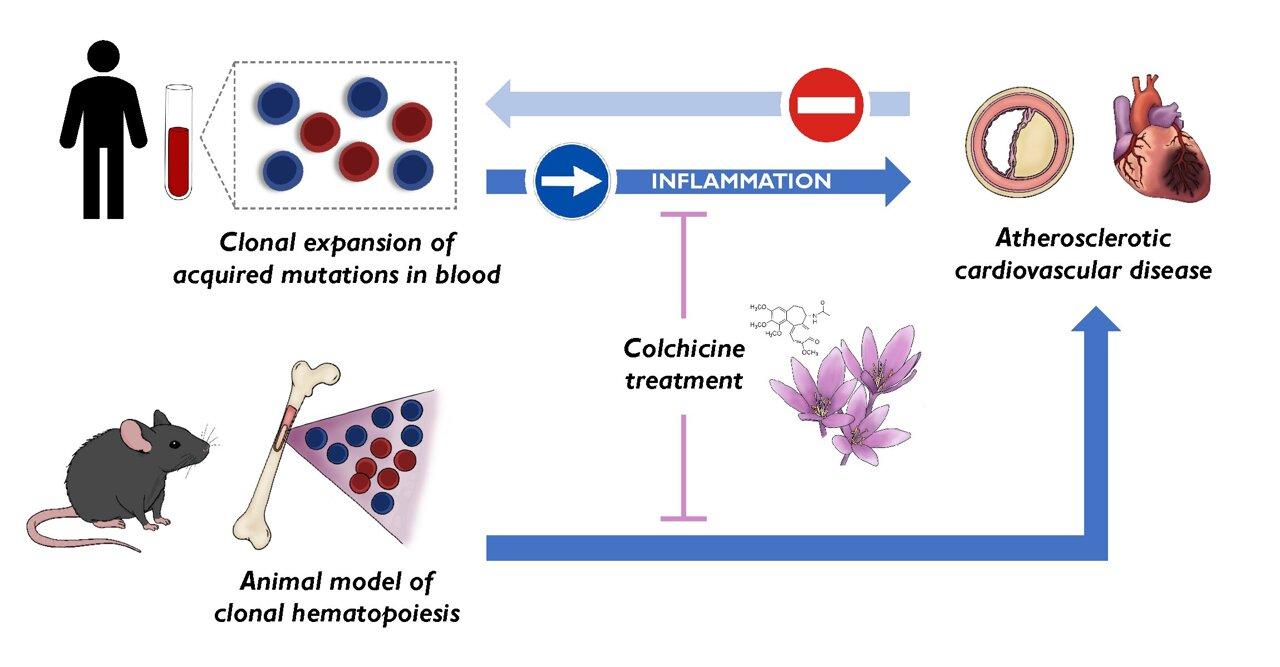 Medical Xpress - medical research advances and health news