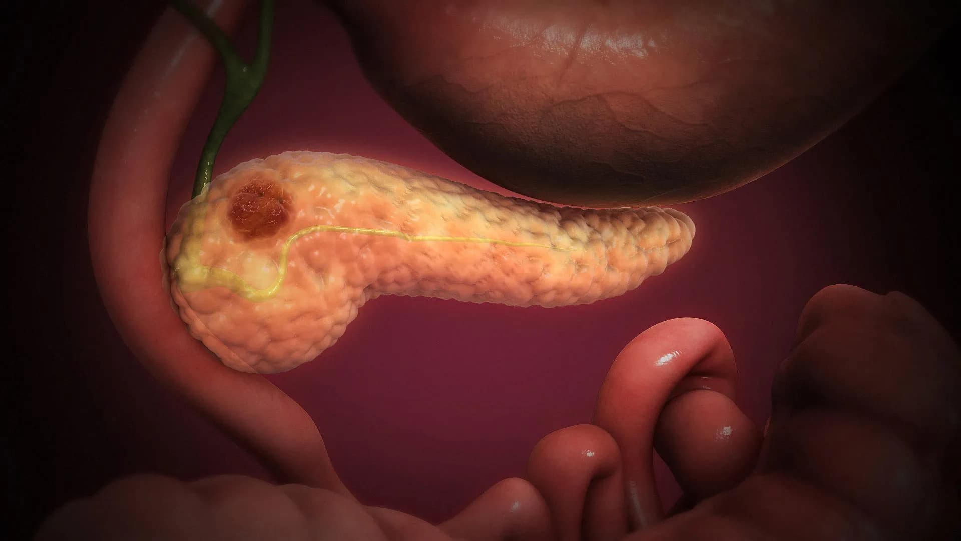ScienceDaily